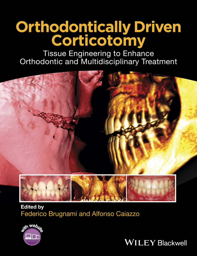 Orthodontically Driven Corticotomy. Tissue Engineering to Enhance Orthodontic and Multidisciplinary Treatment