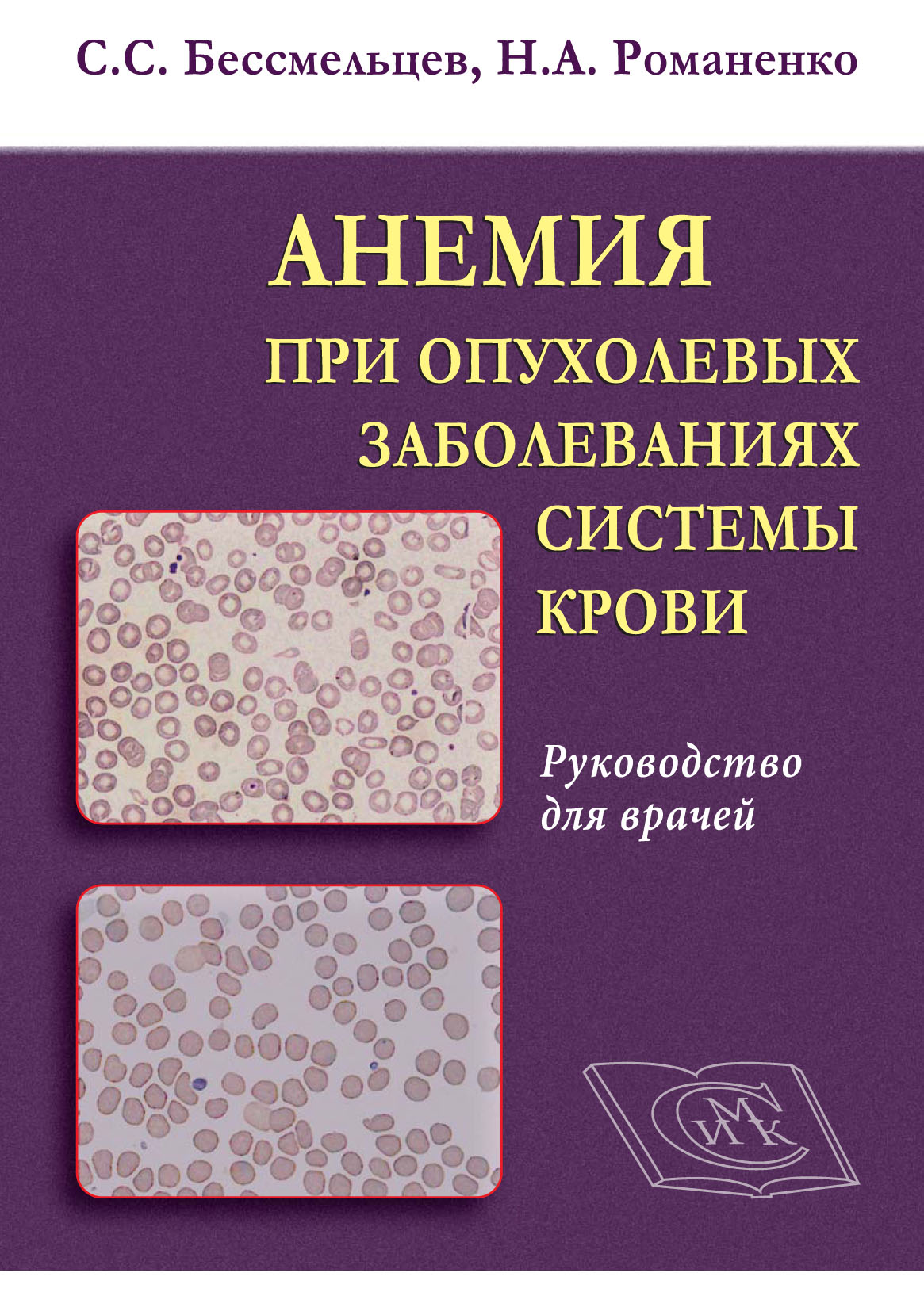 

Анемия при опухолевых заболеваниях системы крови. Руководство для врачей