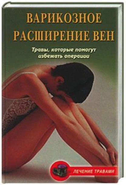 Обложка книги Варикозное расширение вен. Травы, которые помогут избежать операции, Ольга Абрамович