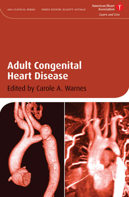 Carole Warnes A. - Adult Congenital Heart Disease