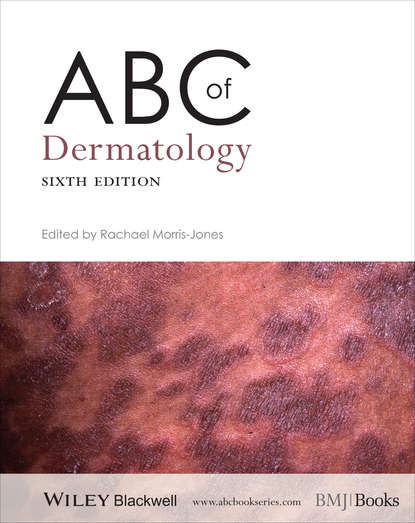 Rachael  Morris-Jones - ABC of Dermatology