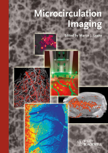 Microcirculation Imaging - Martin Leahy J.