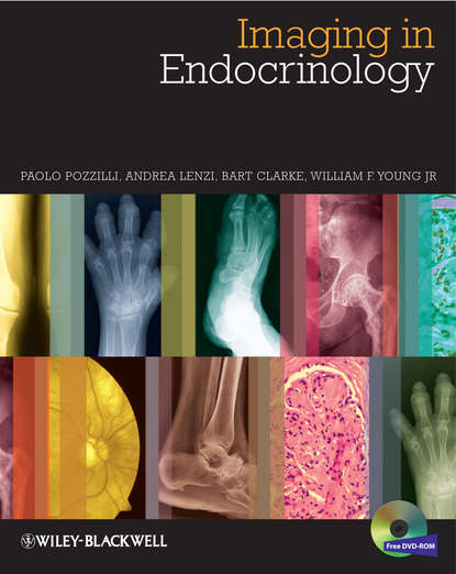 Imaging in Endocrinology - Paolo Pozzilli