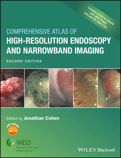 Comprehensive Atlas of High-Resolution Endoscopy and Narrowband Imaging - Группа авторов
