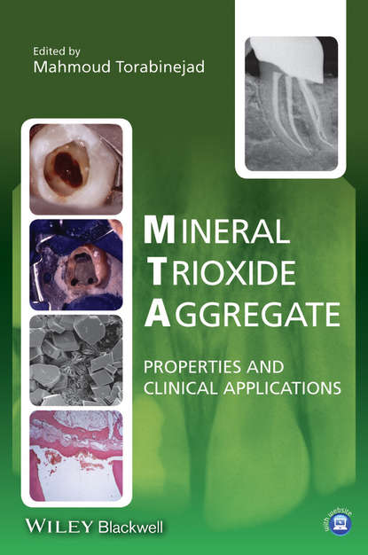 Mineral Trioxide Aggregate - Mahmoud Torabinejad