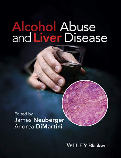 Alcohol Abuse and Liver Disease - Andrea DiMartini