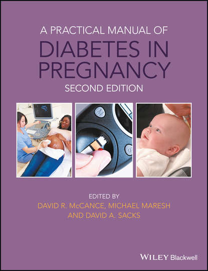 A Practical Manual of Diabetes in Pregnancy - Группа авторов