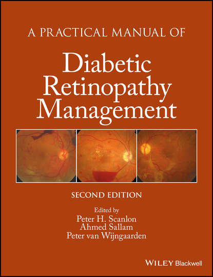 A Practical Manual of Diabetic Retinopathy Management - Группа авторов