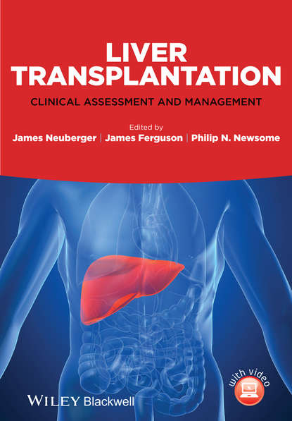 

Liver Transplantation. Clinical Assessment and Management