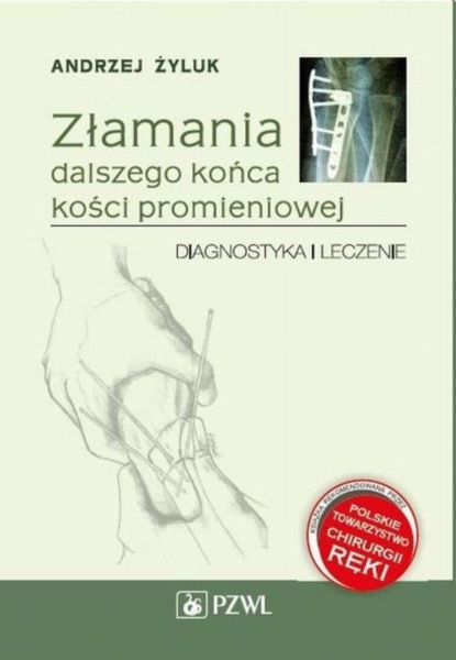 Andrzej Żyluk - Złamania dalszego końca kości promieniowej