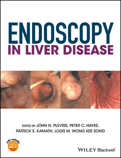 Endoscopy in Liver Disease - Группа авторов