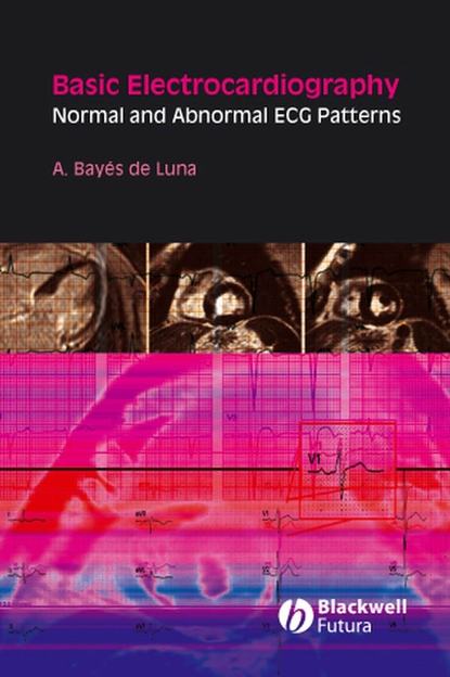 Группа авторов - Basic Electrocardiography