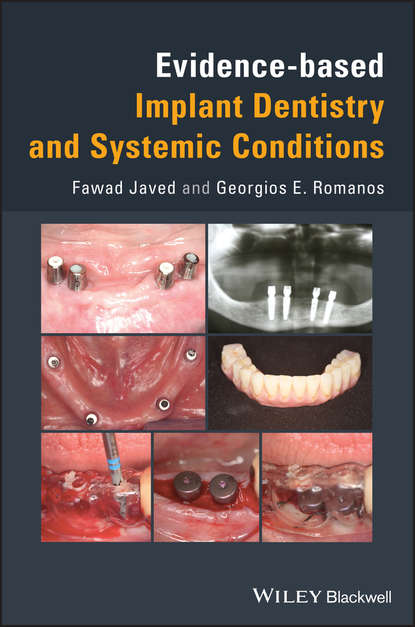 Georgios  Romanos - Evidence-based Implant Dentistry and Systemic Conditions