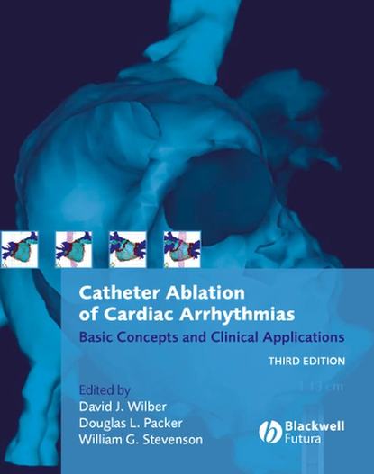 David J. Wilber - Catheter Ablation of Cardiac Arrhythmias