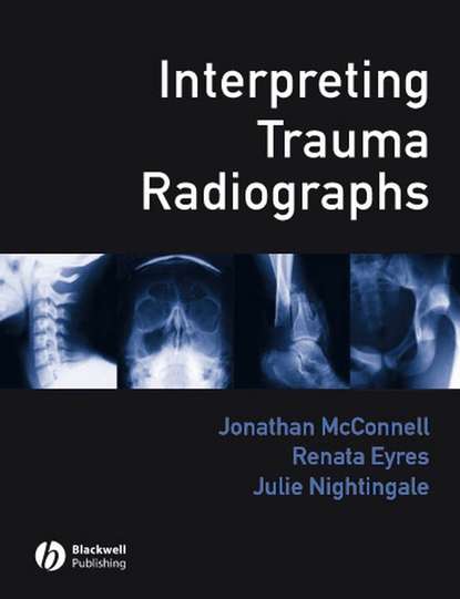 Jonathan  McConnell - Interpreting Trauma Radiographs