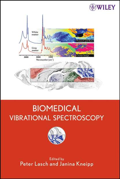 Peter  Lasch - Biomedical Vibrational Spectroscopy