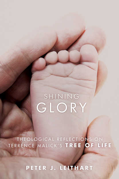 

Shining Glory