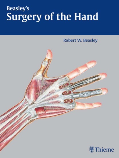 Robert W. Beasley - Beasley's Surgery of the Hand