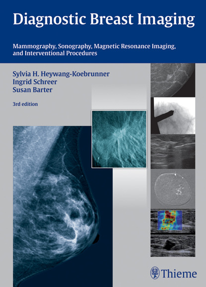 Sylvia H. Heywang-Koebrunner - Diagnostic Breast Imaging