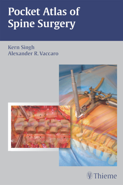 

Pocket Atlas of Spine Surgery