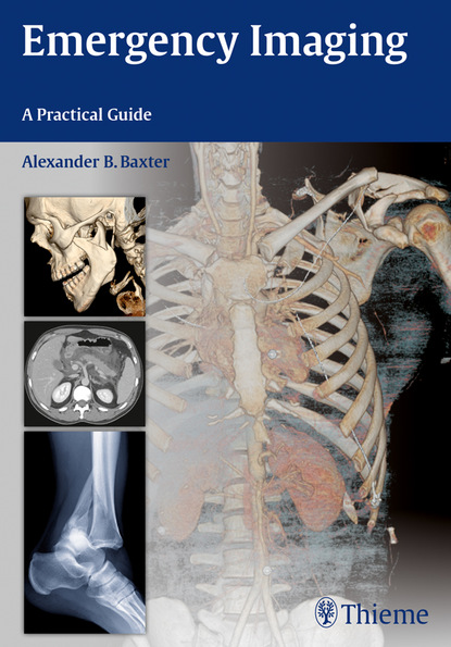 Alexander B. Baxter - Emergency Imaging