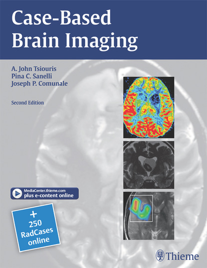 A. John Tsiouris - Case-Based Brain Imaging