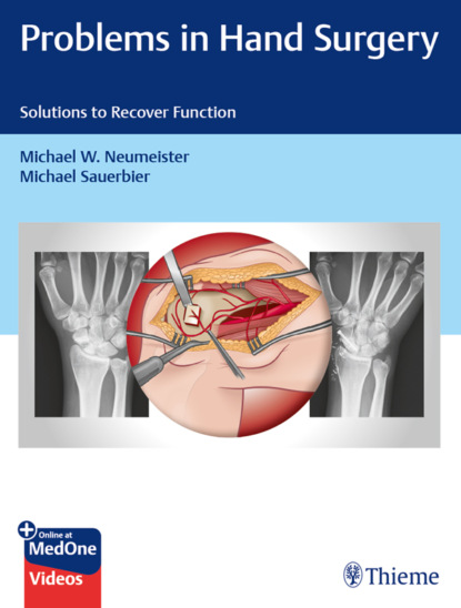 Группа авторов - Problems in Hand Surgery