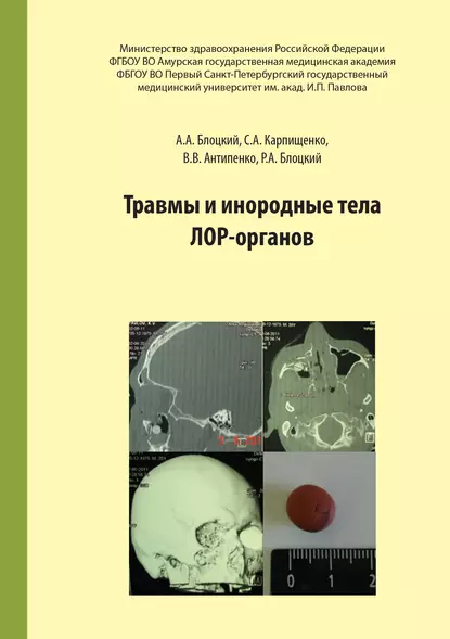 Обложка книги Травмы и инородные тела лор-органов, С. А. Карпищенко