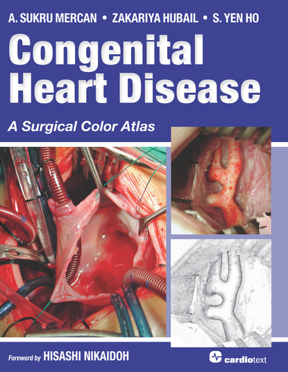 A. Sukru Mercan - Congenital Heart Disease: A Surgical Color Atlas