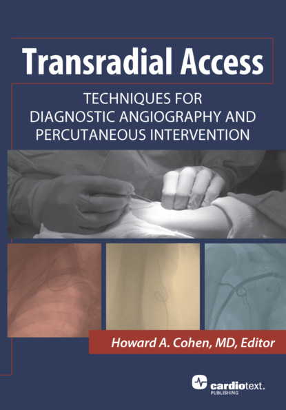 

Transradial Access: Techniques for Diagnostic Angiography and Percutaneous Intervention