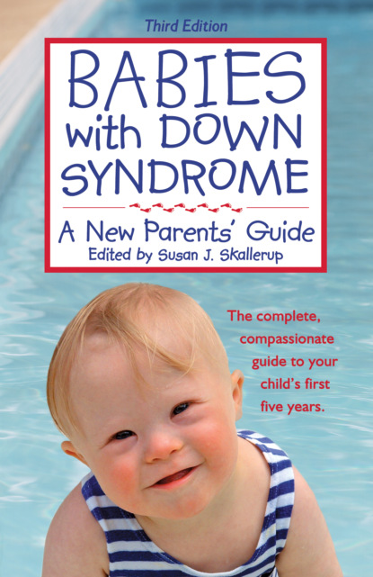 Группа авторов - Babies with Down Syndrome, Third Edition