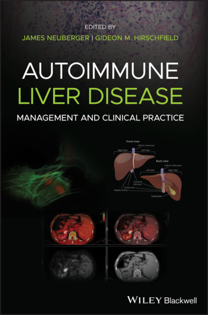 Autoimmune Liver Disease - Группа авторов