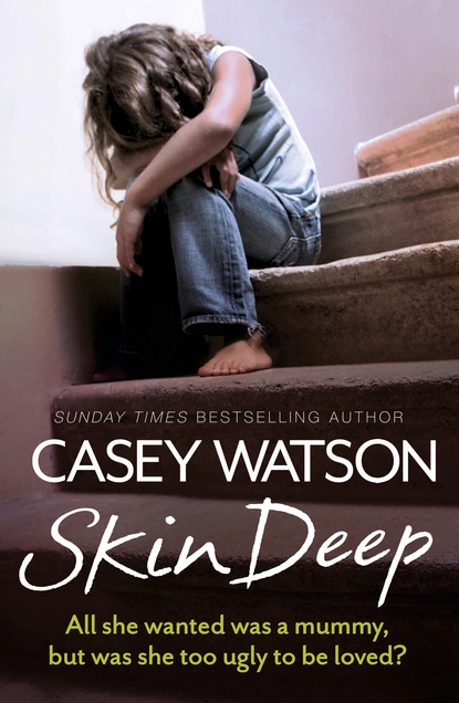 Обложка книги Skin Deep, Casey Watson