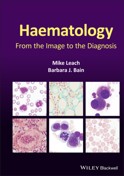 Barbara J. Bain - Haematology
