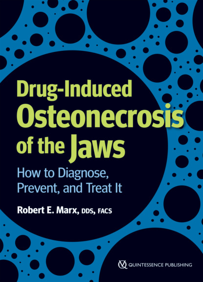 

Drug-Induced Osteonecrosis of the Jaws